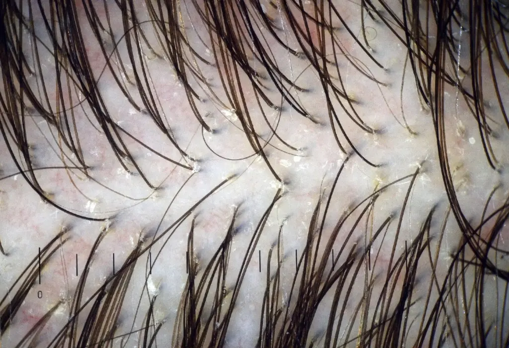 Comprehensive Hair and Scalp Evaluation