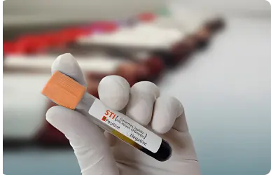 Sexually Transmitted Diseases