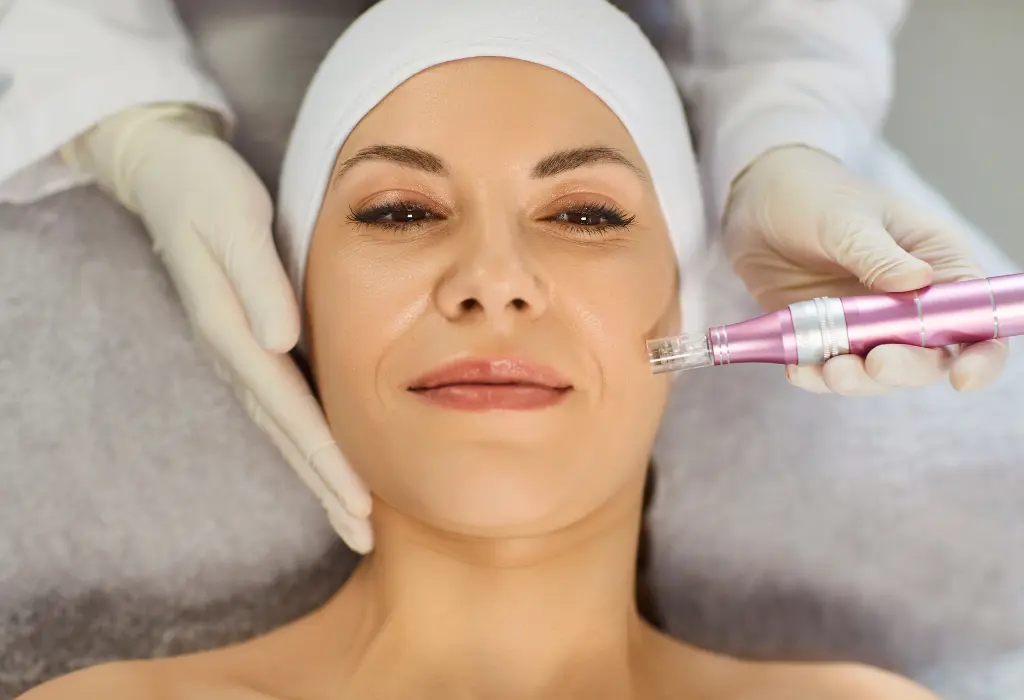 Who Is a Good Candidate for Microneedling Treatment