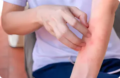 Rashes Aesthetic Services
