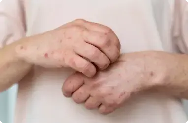 Skin Infections Sick Visits