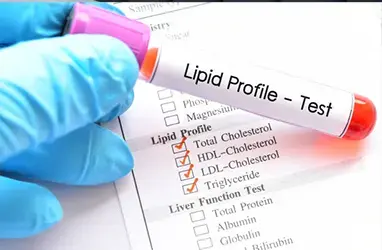 HIgh Cholestrol | Thyroid Treatment