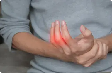 Lupus and hair loss